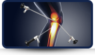 Arthroscopic Treatment of Hip, Knee and Shoulder
